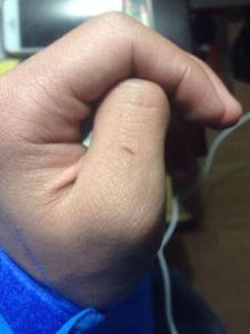 如果被猫抓了怎么办 及时用浓肥皂水清洗伤口